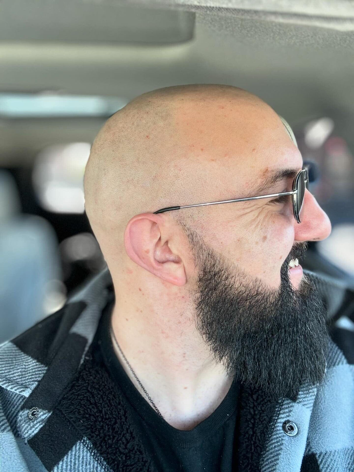 The Complete Bald Head Care System