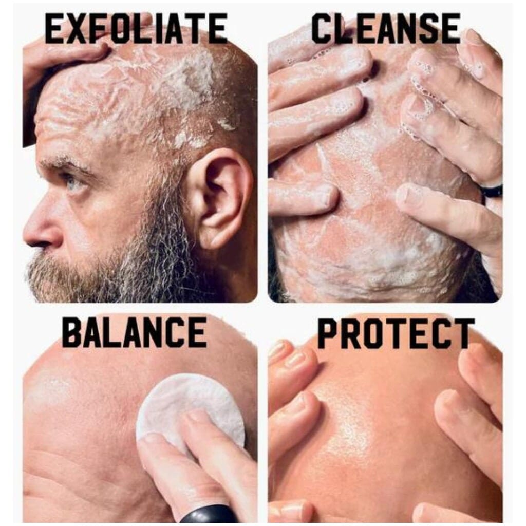 The Complete Bald Head Care System