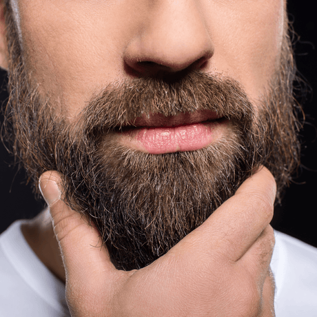 Itchy Beard Syndrome