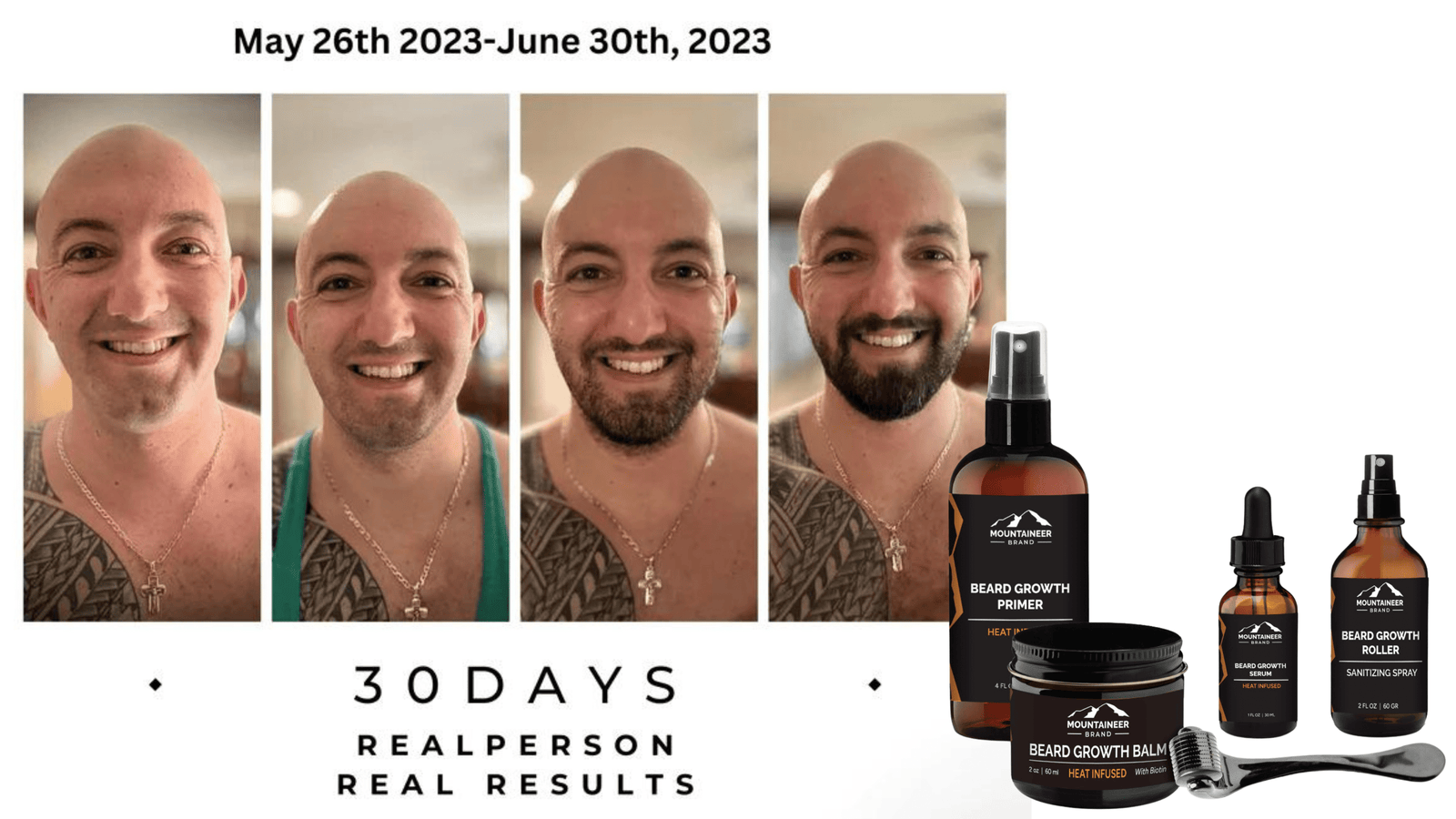 Unlocking Beard Growth Potential: The Power of Microneedling