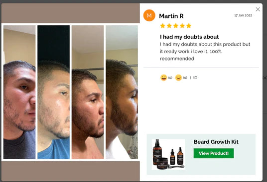 Unlocking Beard Growth Potential: The Science Behind Our Beard Growth Products