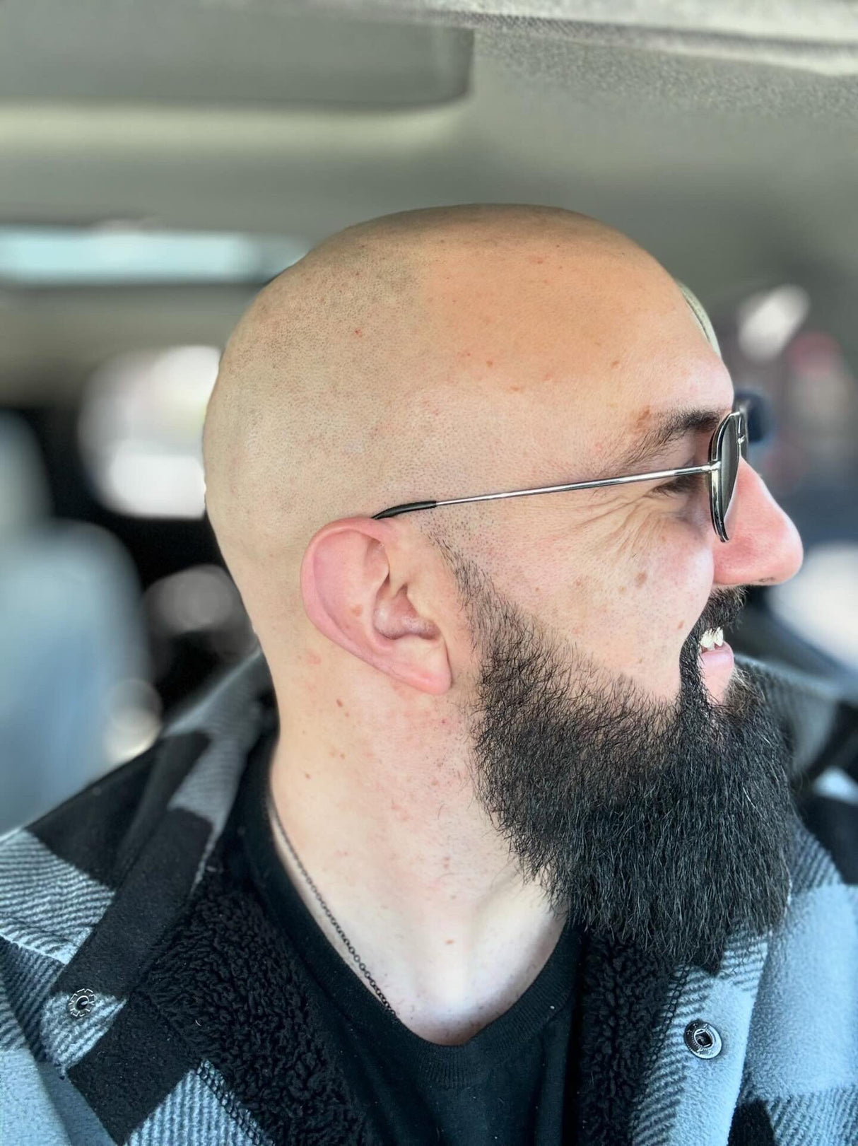 A profile view of a person with a nourished Mountaineer Brand Products Bald and Bearded Kit head and a full beard wearing glasses.