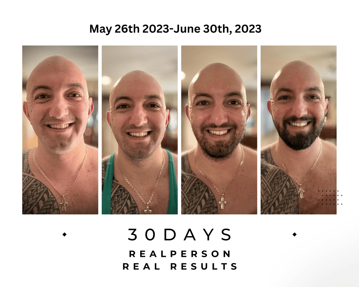 Four portrait photos of a smiling bald man using Mountaineer Brand Products Essential Beard Growth System, showing progressive beard growth over five days, titled "May 26th, 2023 - June 30th.